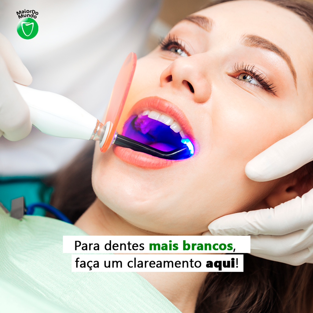 Para dentes mais brancos, faça um clareamento dental na OdontoCompany Pindamonhangaba